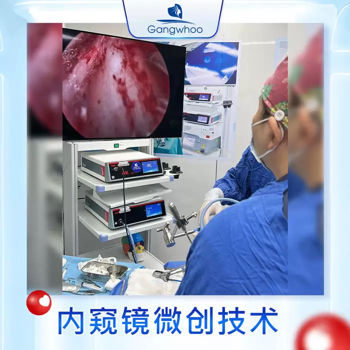 zh thu gon canh mui 9