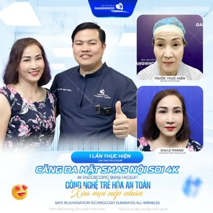Căng da mặt SMAS nội soi 4K: Xóa nhăn sâu, trẻ hóa gương mặt 10-20 tuổi chỉ sau một lần thực hiện