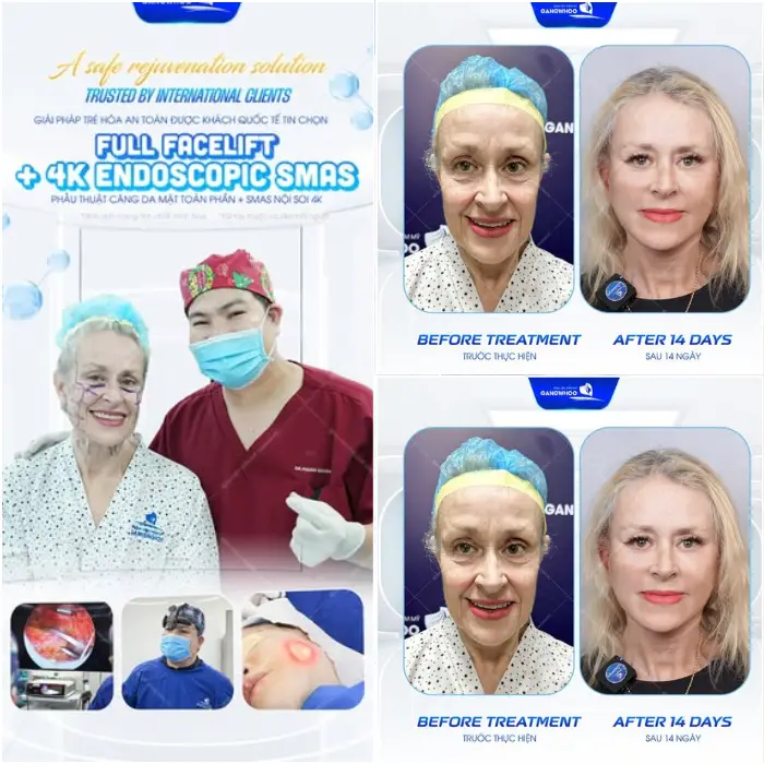 Gangwhoo đón tiếp hàng ngàn khách hàng quốc tế đến thực hiện dịch vụ làm đẹp cao cấp