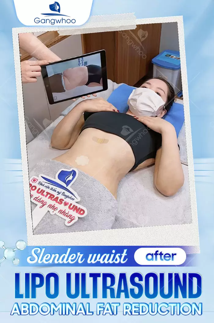 en hut mo cho nguoi nuoc ngoai o viet nam