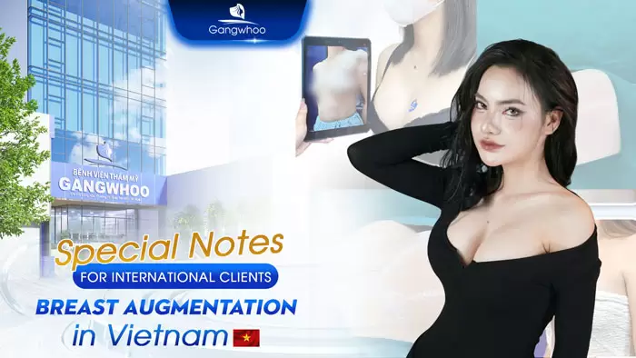 en luu y cho kh quoc te khi nang nguc tai viet nam 1