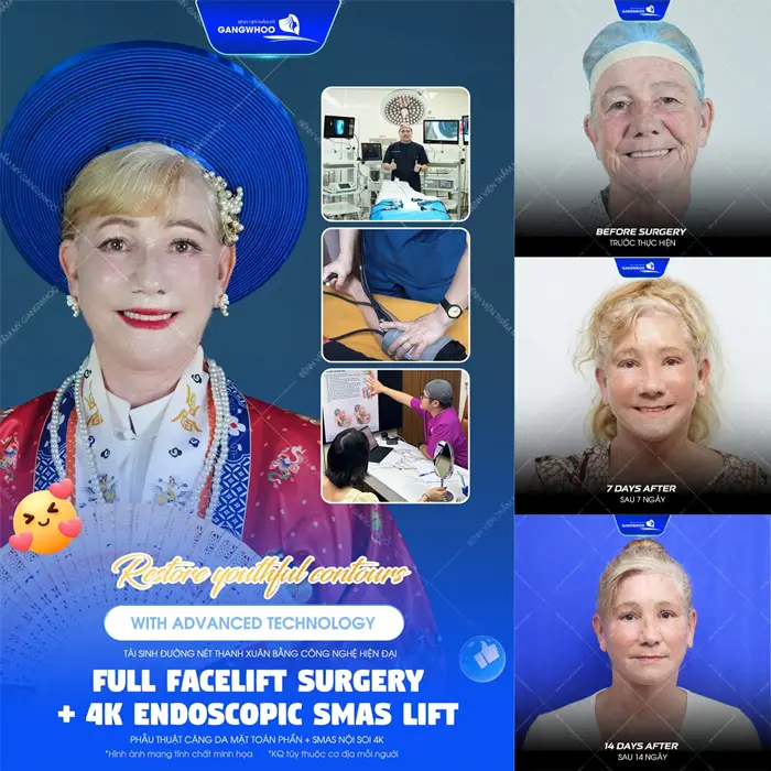 Biến Ước Mơ Thành Sự Thật Mrs. Yvonne Hoàn Thành Mục Tiêu Trẻ Hóa Ở Tuổi 65 1 Trẻ hóa diện mạo với công nghệ và quy trình hiện đại vị khách hàng đến từ Úc rạng rỡ hơn từng ngày sau phẫu thuật