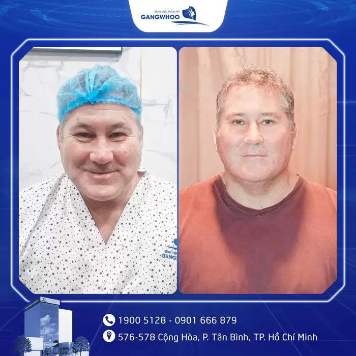 Gangwhoo Cosmetic Hospital - The True Korean Beauty Destination 53 cang da mat 3