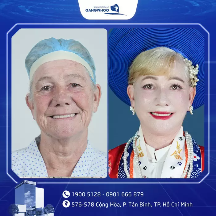 Gangwhoo Cosmetic Hospital - The True Korean Beauty Destination 54 cang da mat 4