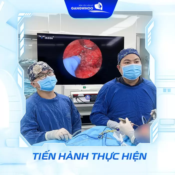 Căng Da Mặt Deep Plane: Giải Pháp Trẻ Hóa Làn Da Toàn Diện & An Toàn