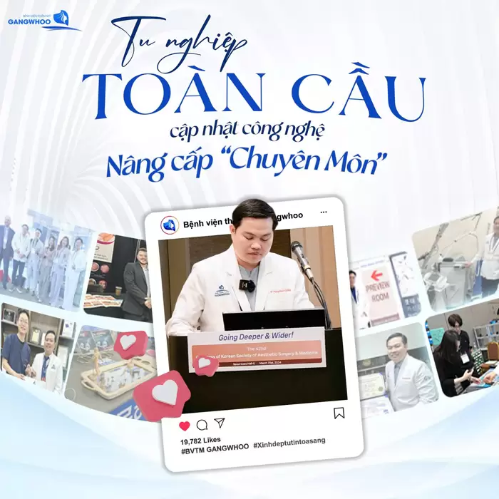 Căng Da Mặt Deep Plane: Giải Pháp Trẻ Hóa Làn Da Toàn Diện & An Toàn