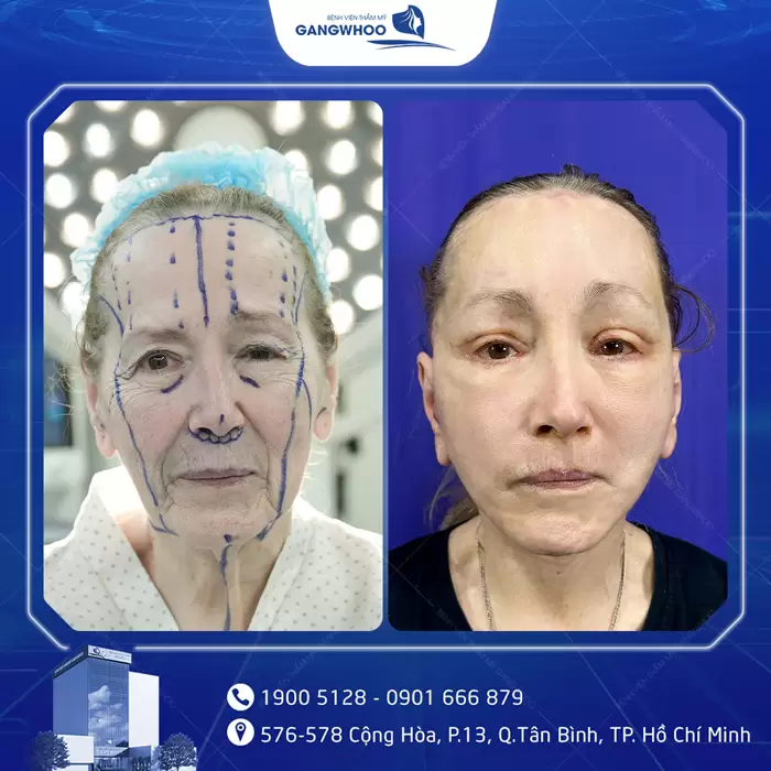 cang da mat hinh anh 3