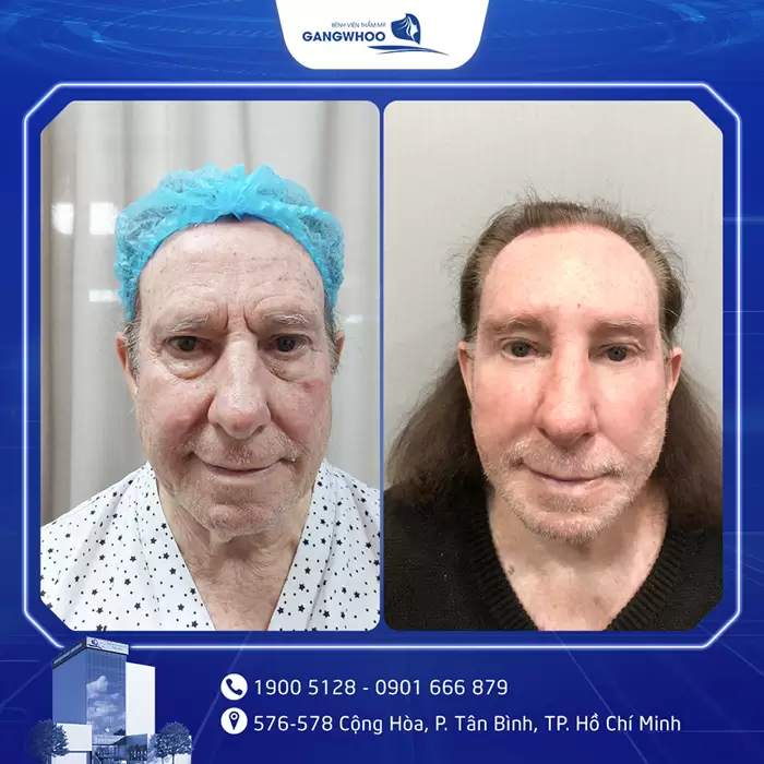 cang da mat hinh anh 4