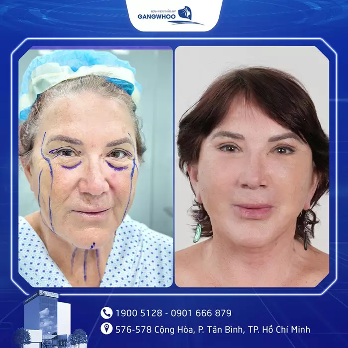 cang da mat hinh anh 5