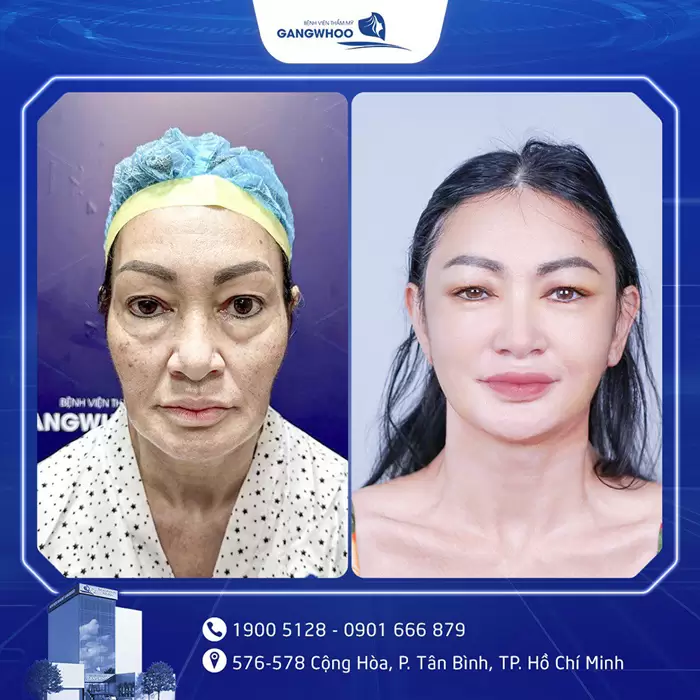 cang da mat hinh anh 7