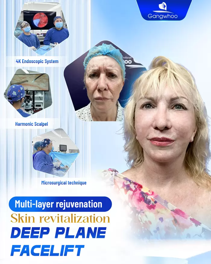 en cang da mat deep plane 9