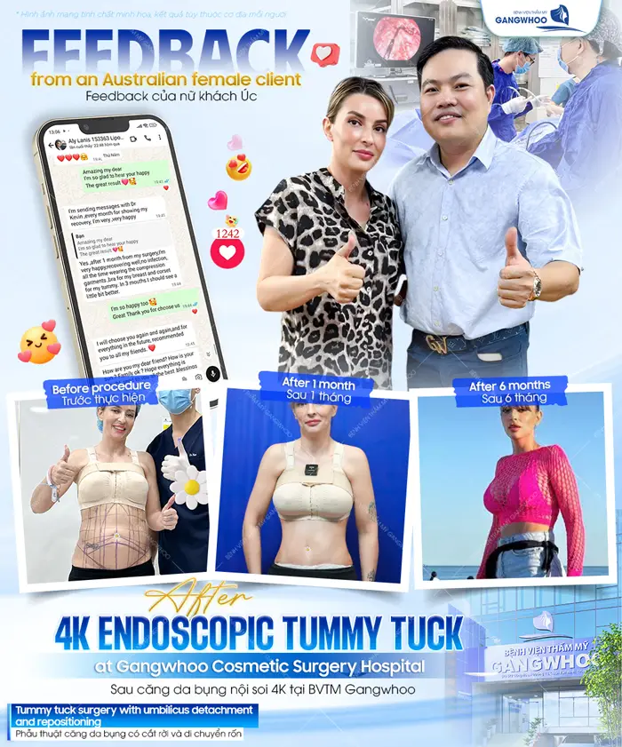 Feedback của khách hàng sau khi thực hiện phẫu thuật thẩm mỹ tại bệnh viện thẩm mỹ Gangwhoo 