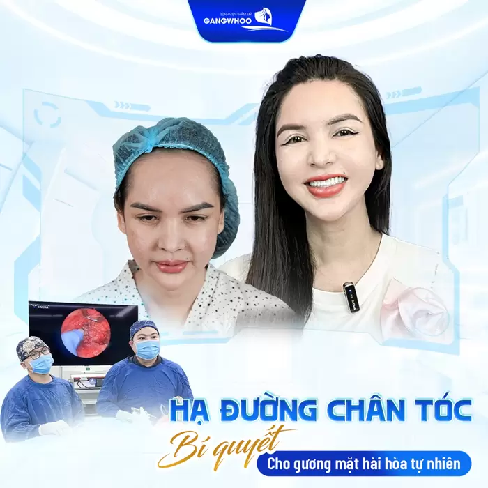 Hạ Đường Chân Tóc Có Bị Rụng Tóc Không? Giải Đáp Từ Bác Sĩ