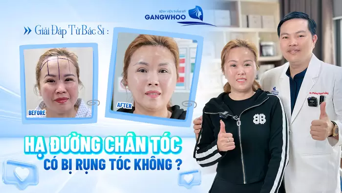 Giải đáp từ bác sĩ: Hạ đường chân tóc có bị rụng tóc không?