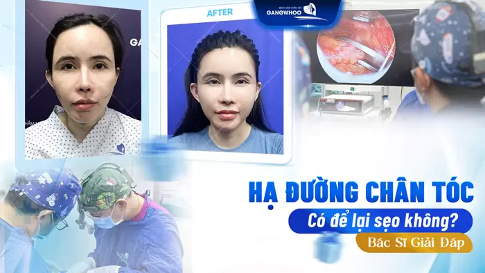 ha duong chan toc co de lai seo khong