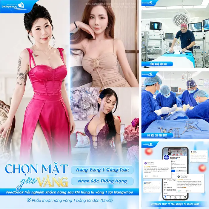 Nâng Ngực Túi GCA Perle Bí quyết Cho Vòng 1 Bền Đẹp Tự Nhiên Và An Toàn 4 Chọn mặt gửi vàng nâng vòng 1 căng tròn, nhan sắc đẹp thăng hạng tại bệnh viện thẩm mỹ Gangwhoo
