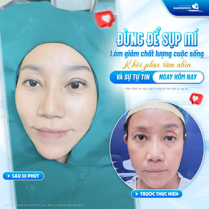 Khôi phục tầm nhìn cải thiện tình trạng mắt sụp mí cải thiện chất lượng cuộc sống thêm rạng rỡ và tươi vui