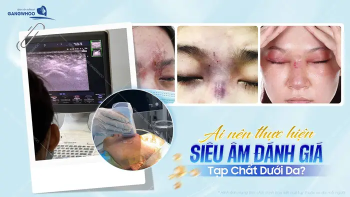 Ai Nên Thực Hiện Siêu Âm Đánh Giá Tạp Chất Dưới Da? 1 Ai nên thực hiện siêu âm đánh giá tạp chất dưới da