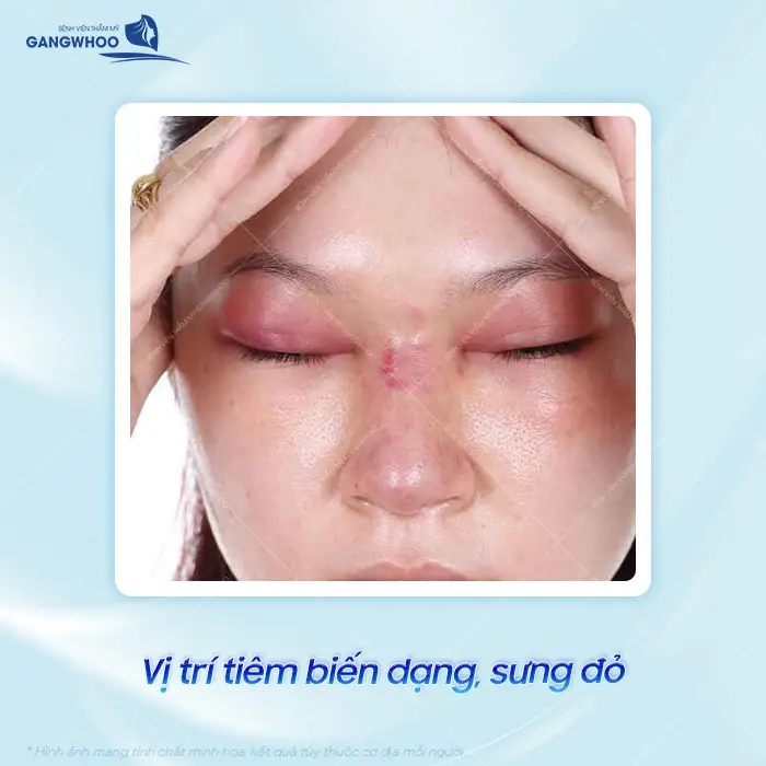 Ai Nên Thực Hiện Siêu Âm Đánh Giá Tạp Chất Dưới Da? 3 Ai nên thực hiện siêu âm đánh giá tạp chất dưới da
