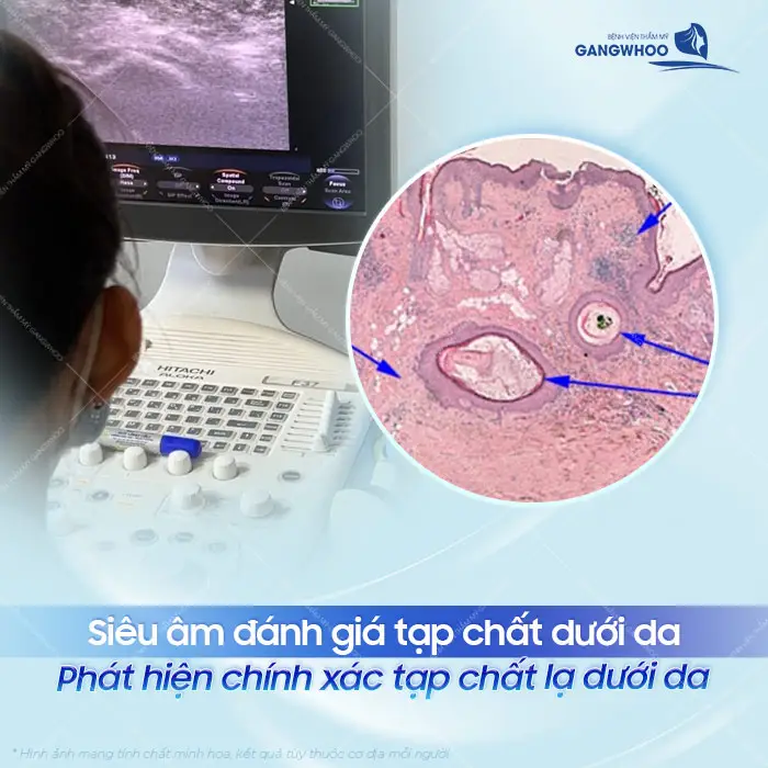 Ai Nên Thực Hiện Siêu Âm Đánh Giá Tạp Chất Dưới Da? 5 Ai nên thực hiện siêu âm đánh giá tạp chất dưới da