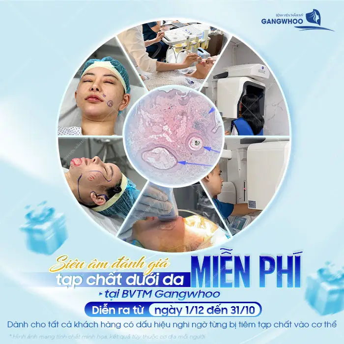 Ai Nên Thực Hiện Siêu Âm Đánh Giá Tạp Chất Dưới Da? 6 Ai nên thực hiện siêu âm đánh giá tạp chất dưới da