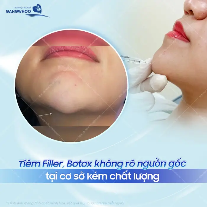 Ai Nên Thực Hiện Siêu Âm Đánh Giá Tạp Chất Dưới Da? 2 Ai nên thực hiện siêu âm đánh giá tạp chất dưới da