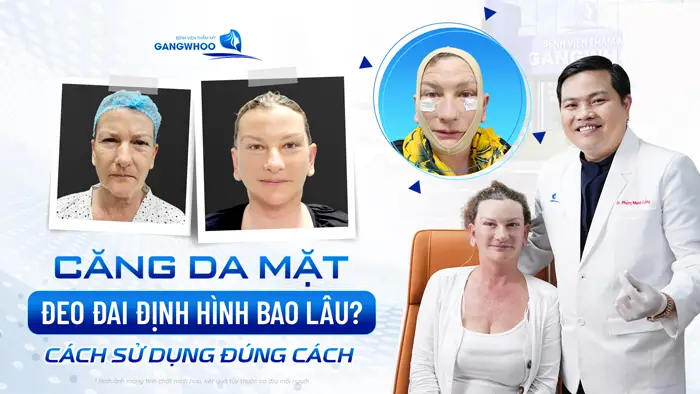 cang da mat deo dai dinh hinh bao lau
