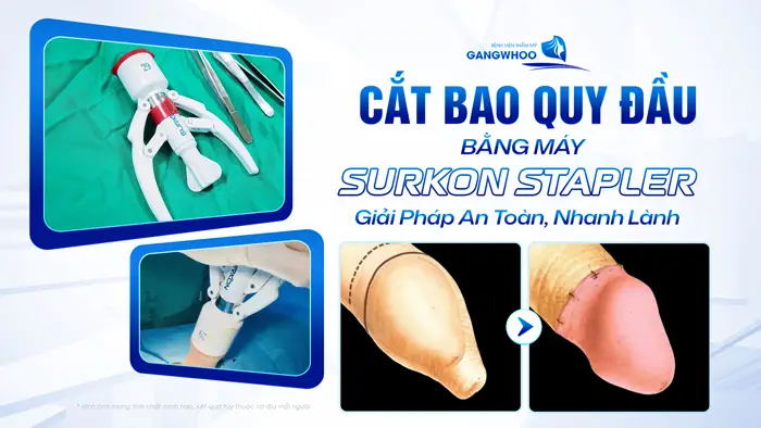 cat bao quy dau bang may Surkon Stapler