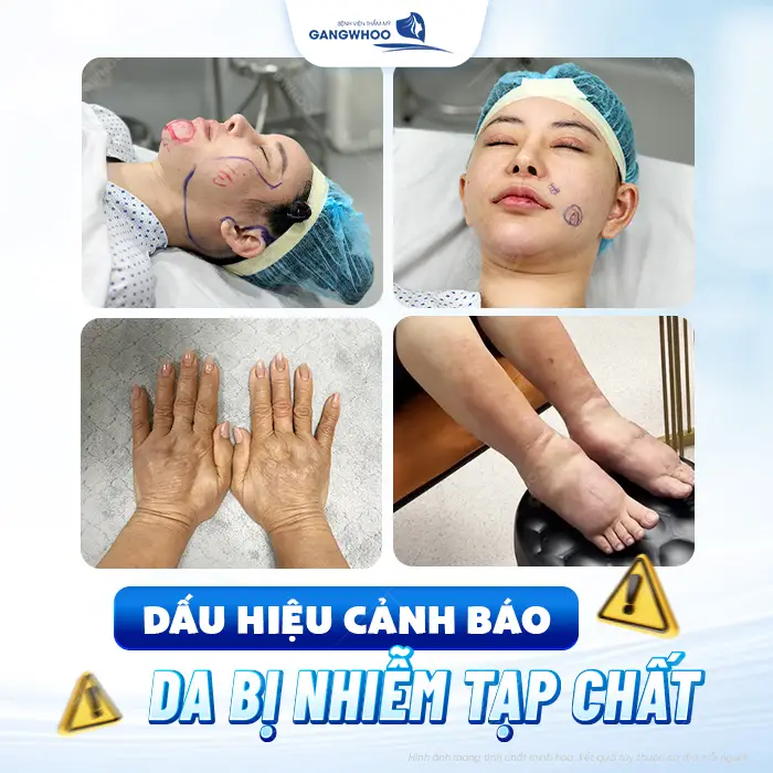 Siêm âm đánh giá tạp chất dưới da cơ hội cho các đối tượng nghi ngờ đã bị tiêm tạp chất vào cơ thể