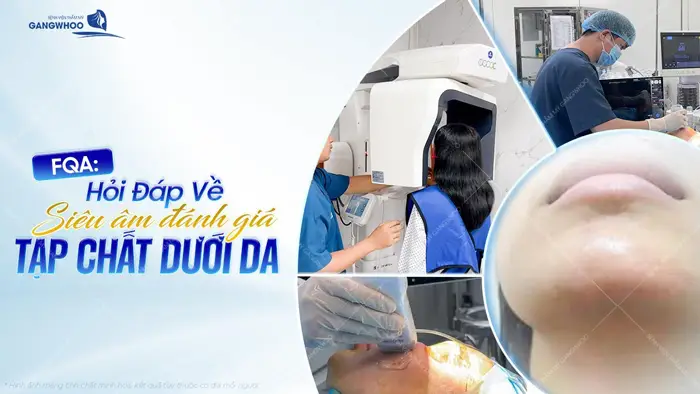 FQA: Hỏi Đáp Về Siêu Âm Đánh Giá Tạp Chất Dưới Da 1 FQA: Hỏi Đáp Về Siêu Âm Đánh Giá Tạp Chất Dưới Da