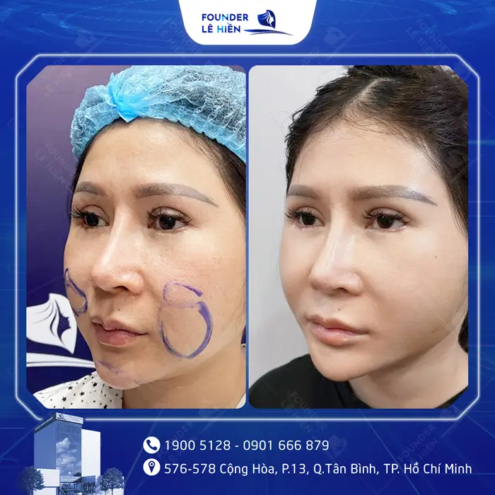 khach hang nao silicon 3