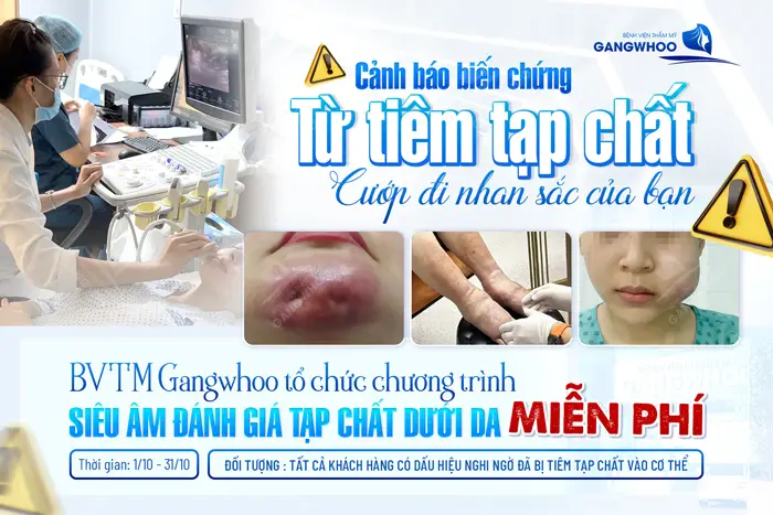 Siêm âm đánh giá tạp chất dưới da cơ hội cho các đối tượng nghi ngờ đã bị tiêm tạp chất vào cơ thể