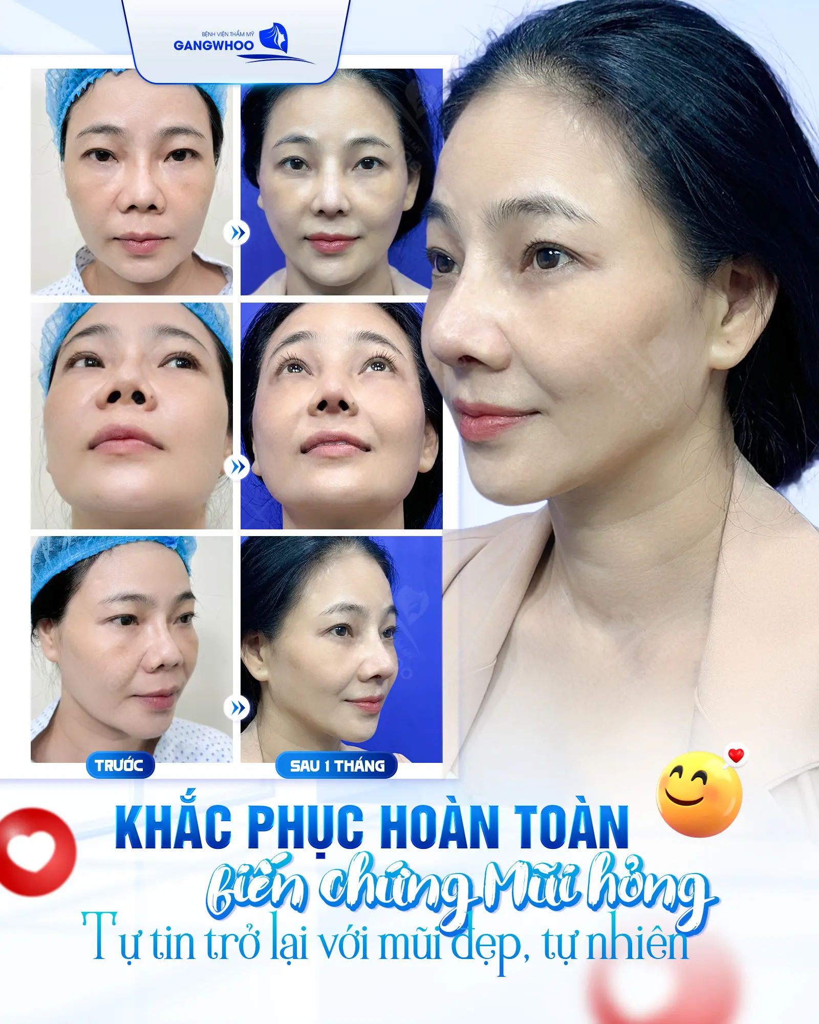 sua mui hong 7