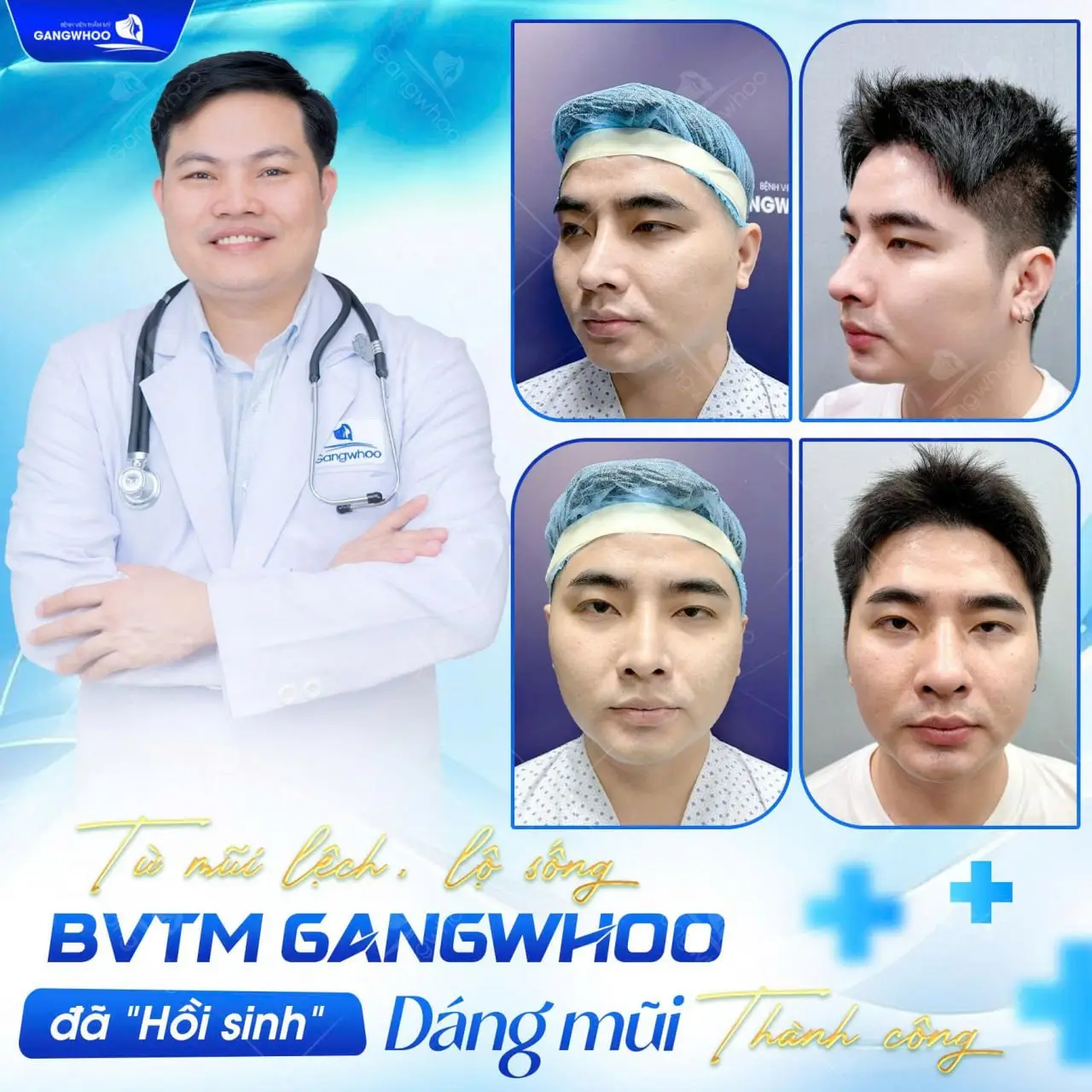 sua mui hong cho nam 1