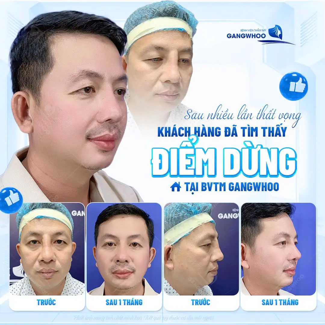 sua mui hong cho nam