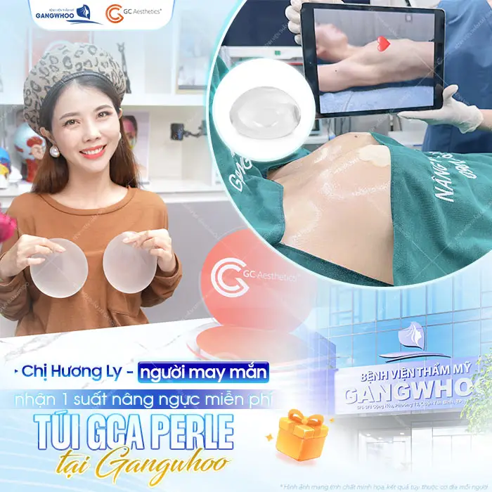 Chị Hương Ly người may mắn nhận 1 suất nâng ngực miễn phí túi GCA Perle