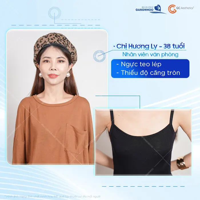 Chị Ly 38 tuổi nhân viên văn phong có vòng 1 teo lép và thiếu độ căng tròn