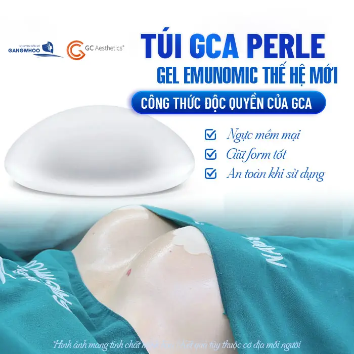 Túi ngực GCA Perle cao cấp thế hệ mới giúp ngực đẹp mềm mại và an toàn khi sử dụng