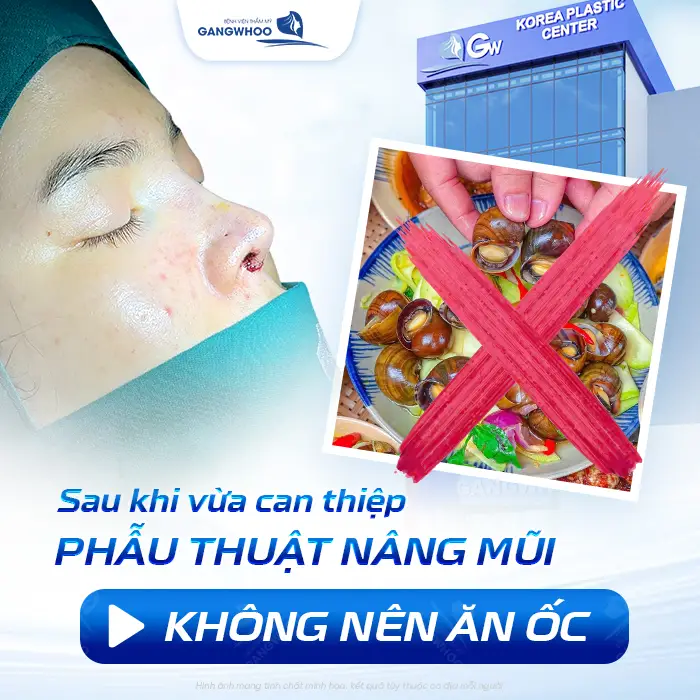 Nâng Mũi Ăn Được Ốc Không? Bao Lâu Ăn Ốc Được?