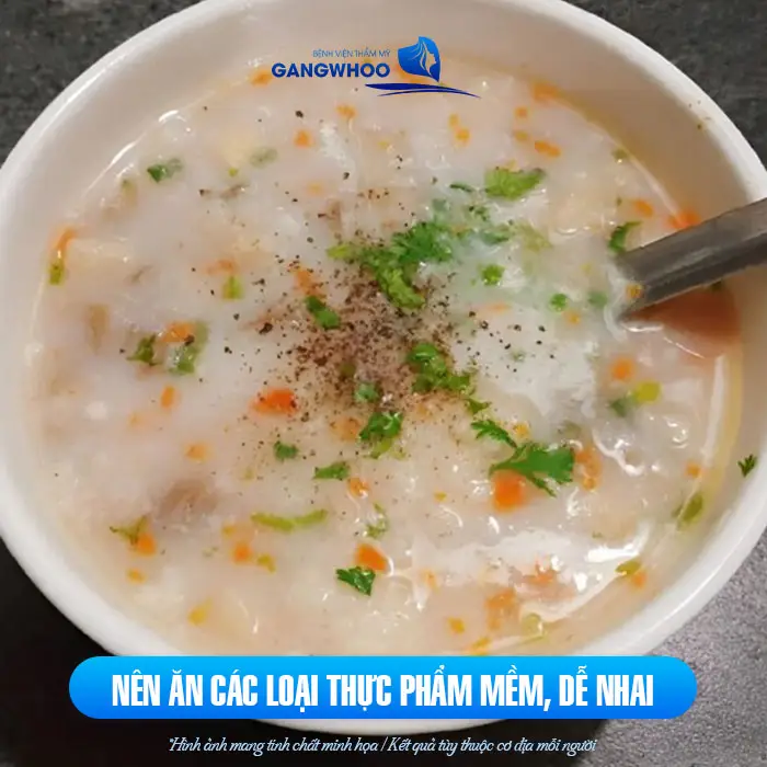 Nâng Mũi Bao Lâu Được Ăn Trứng Gà? Những Lưu Ý Quan Trọng 7 Nâng Mũi Bao Lâu Được Ăn Trứng Gà? Những Lưu Ý Quan Trọng