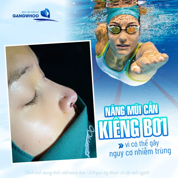 Nâng Mũi Bao Lâu Đi Bơi Được? Những Lưu Ý Khi Đi Bơi 1 Nâng mũi cần kiêng bơi vì có thể gây nguy cơ nhiễm trùng sau phẫu thuật