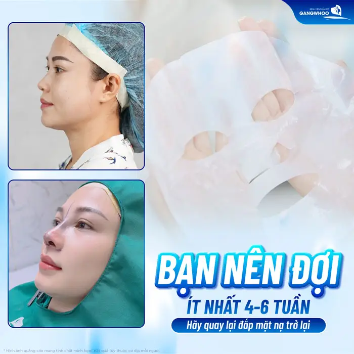 Nâng Mũi Bao Lâu Thì Đắp Mặt Nạ? Tips Dưỡng Da Đúng Cách
