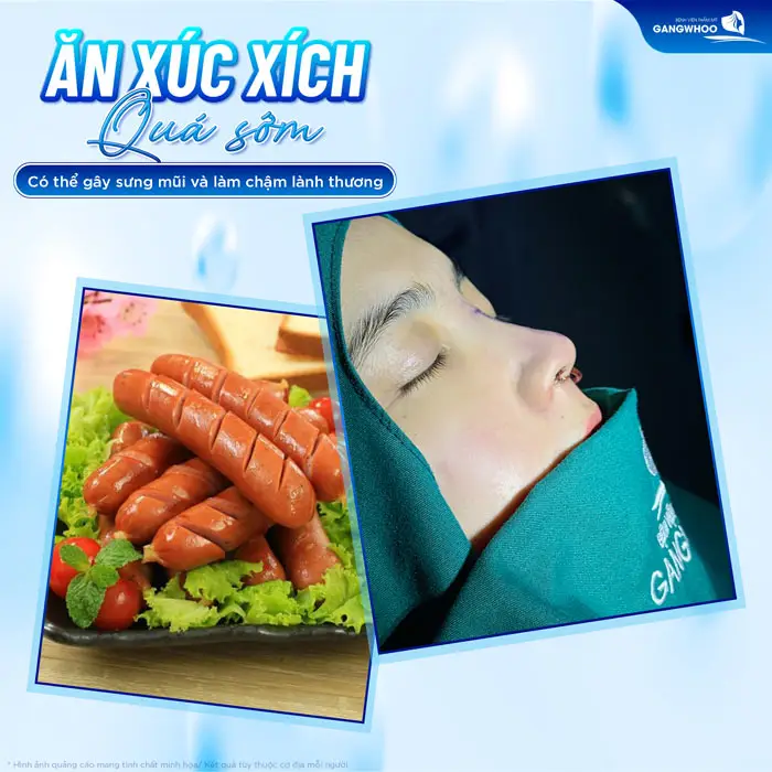 Ăn xúc xích quá sớm có thể gây sưng mũi và làm chậm quá trình lành thương