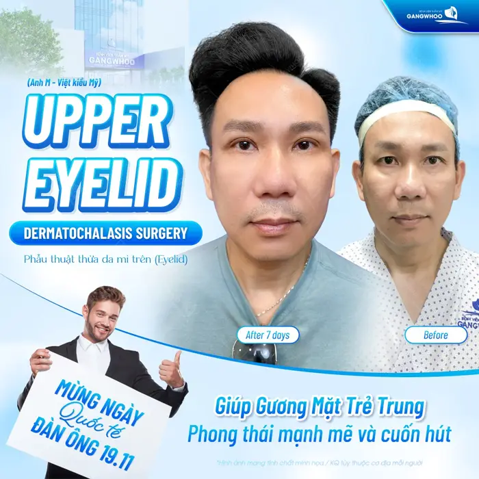 Mừng ngày Quốc tế đàn ông nam giới làm đẹp nhận quà tặng khủng tại BVTM Gangwhoo