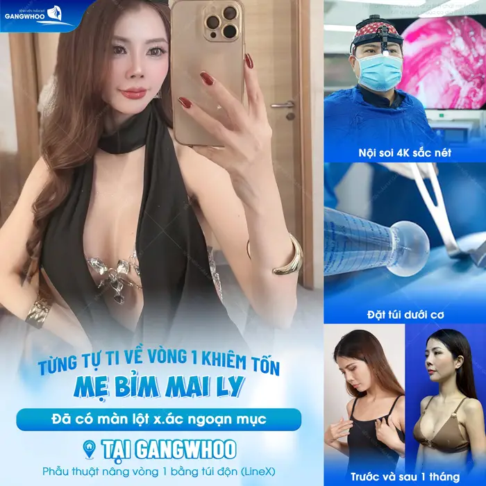 Từng tự ti về vòng 1 khiêm tốn nay chị Ly đã có màn "lột xác" đầy ngoạn mục tại BVTM Gangwhoo