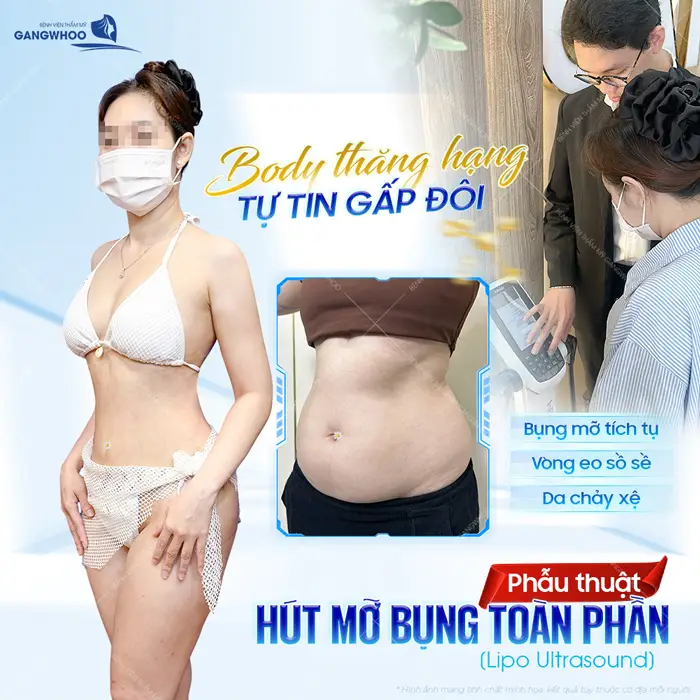 Top 10 Bác Sĩ Hút Mỡ Bụng Tại TPHCM Có Tiếng, Chuyên Môn Cao 8 Top 10 Bác Sĩ Hút Mỡ Bụng Tại TPHCM Có Tiếng, Chuyên Môn Cao