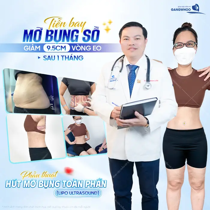 Top 10 Bác Sĩ Hút Mỡ Bụng Tại TPHCM Có Tiếng, Chuyên Môn Cao 3 Top 10 Bác Sĩ Hút Mỡ Bụng Tại TPHCM Có Tiếng, Chuyên Môn Cao