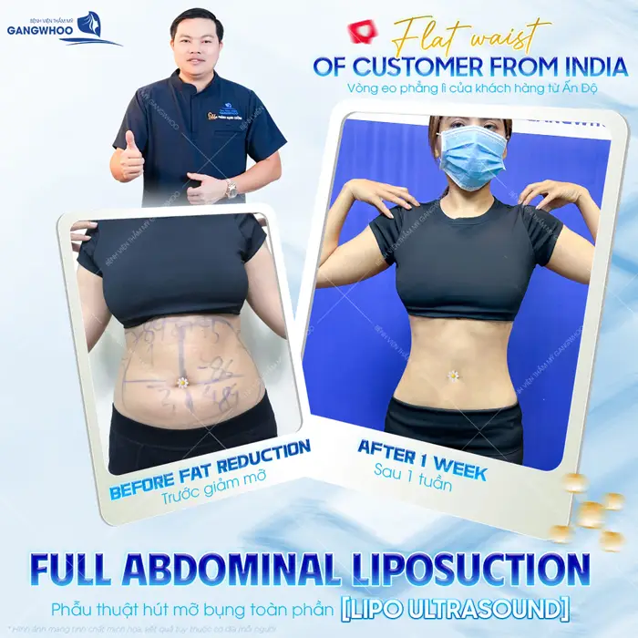 Top 10 Bác Sĩ Hút Mỡ Bụng Tại TPHCM Có Tiếng, Chuyên Môn Cao 5 Top 10 Bác Sĩ Hút Mỡ Bụng Tại TPHCM Có Tiếng, Chuyên Môn Cao