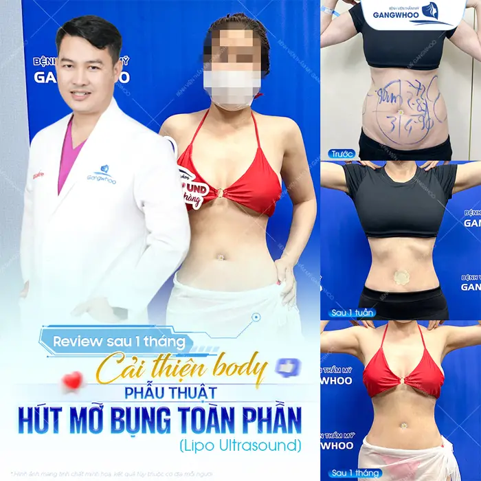 Cải thiện body dáng nuột nà quyến rũ sự khác biệt chỉ sau 1 tháng thực hiện