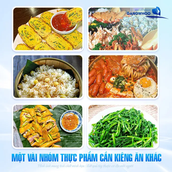 Cắt Mí Mắt Kiêng Thịt Bò Bao Lâu? Bác Sĩ Giải Đáp